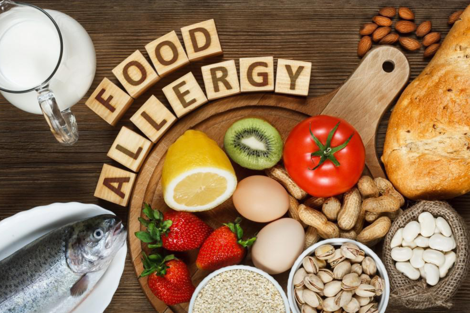 DiningWebsite_HeaderImages_food allergies